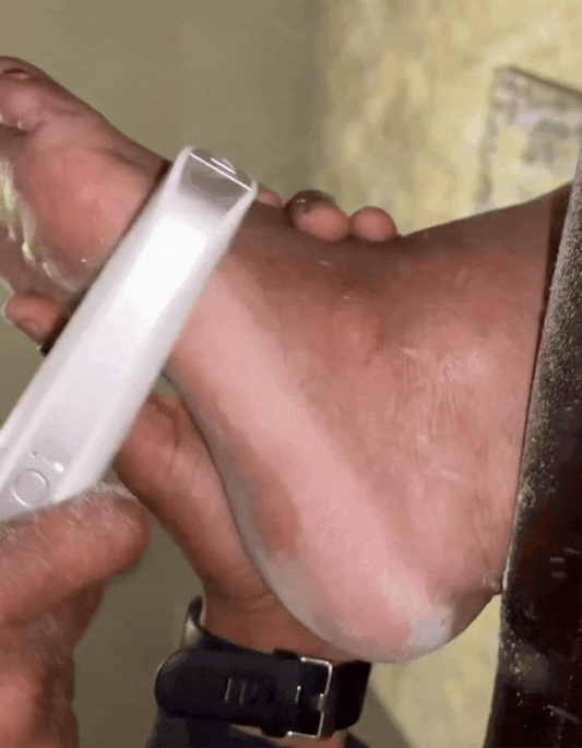 Removedor Eléctrico De Callos Recargable
